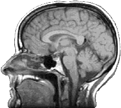 brain